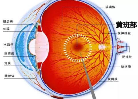 黃斑退化怎么治療