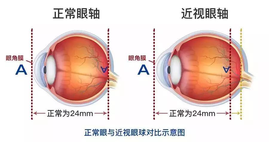 全飛秒和半飛秒的區(qū)別在哪里